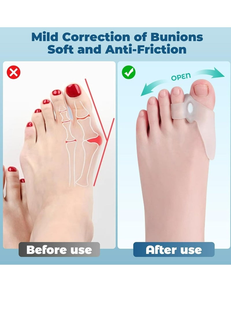 مجموعة مصحح عظم الإصبع الكبير قابل للتعديل وفاصل أصابع القدم للرجال والنساء لتخفيف ألم الأصابع - Image 3